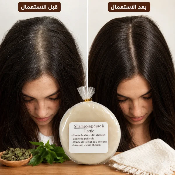 شامبو ضد تساقط الشعر — image 3