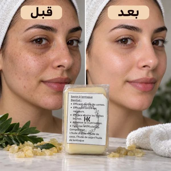 صابون المستكة — image 4
