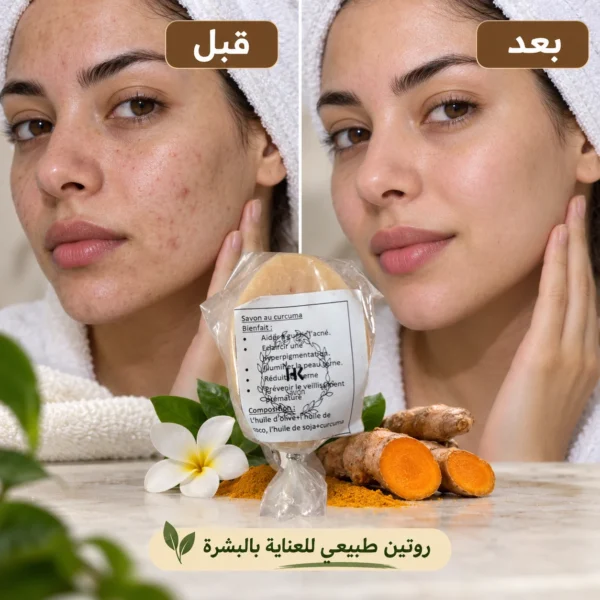 صابون الكركم — image 4