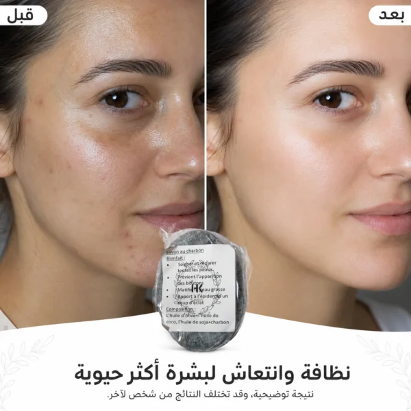 صابون الفحم — image 4